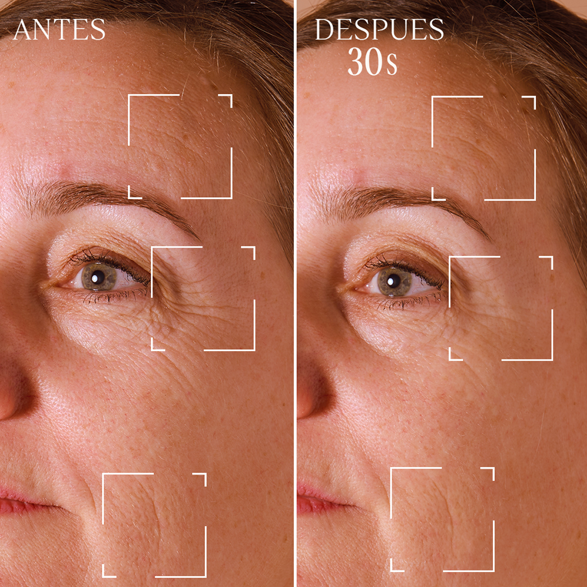 Corrector de arrugas Immortelle Divina